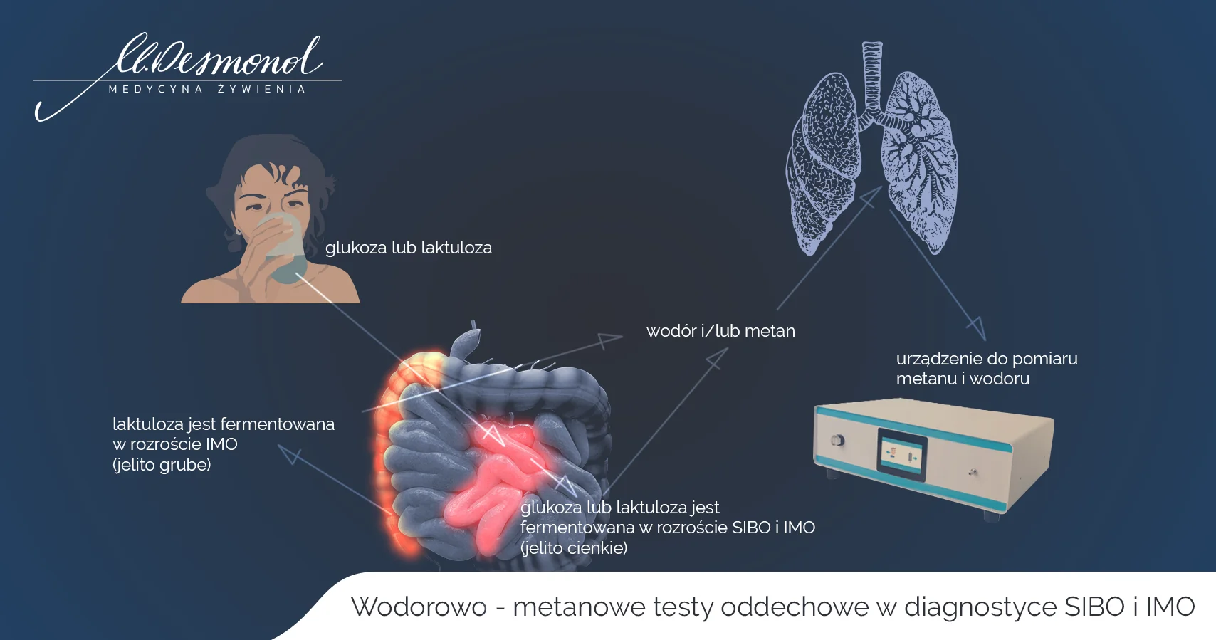 Wodorowo - metanowe testy oddechowe w diagnostyce SIBO i IMO testy metanowo -wodorowe SIBO IMO Małgorzata DESMOND