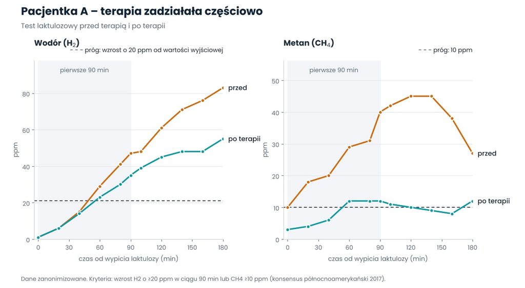 Test oddechowy przed i po terapii – nawrót SIBO, częściowa poprawa