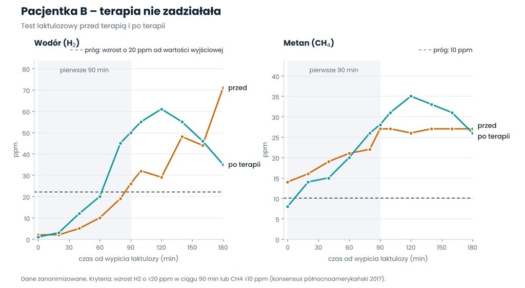 Test oddechowy przed i po terapii – nawrót SIBO, częściowa poprawa